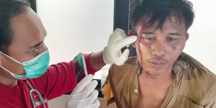 Pencuri Sepeda Motor di Pandeglang Dihajar Massa Hingga Babak Belur