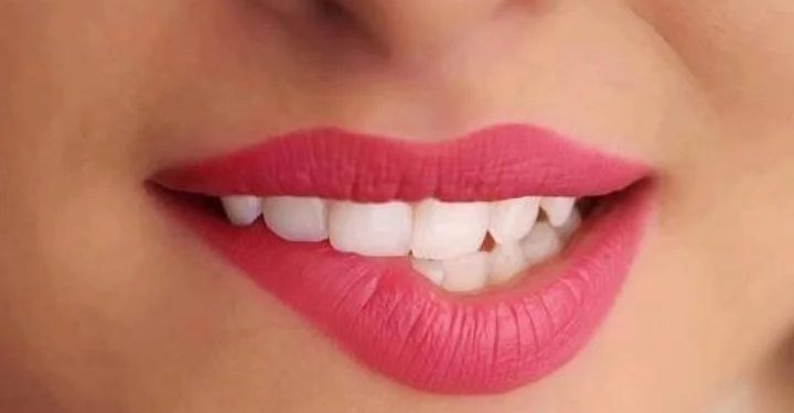 Tips Mencegah Bibir Kering untuk Mendapatkan Bibir Sehat dan Lembap