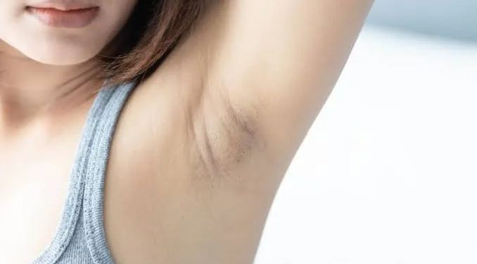 Manfaat Waxing Bulu Ketiak Selain Hanya untuk Penampilan